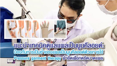 แนะนำเทคนิคดูแลแผลเป็นนูนคีลอยด์: ป้องกันการเป็นซ้ำของแผลเป็นนูนคีลอยด์ด้วยการใช้ Pressure garment therapy ผ้ายืดเพื่อกดรัดบาดแผล